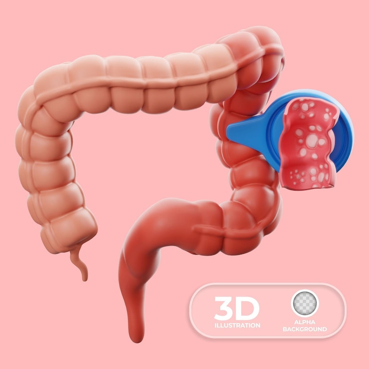 대장내시경 후 식사