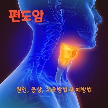 편도암