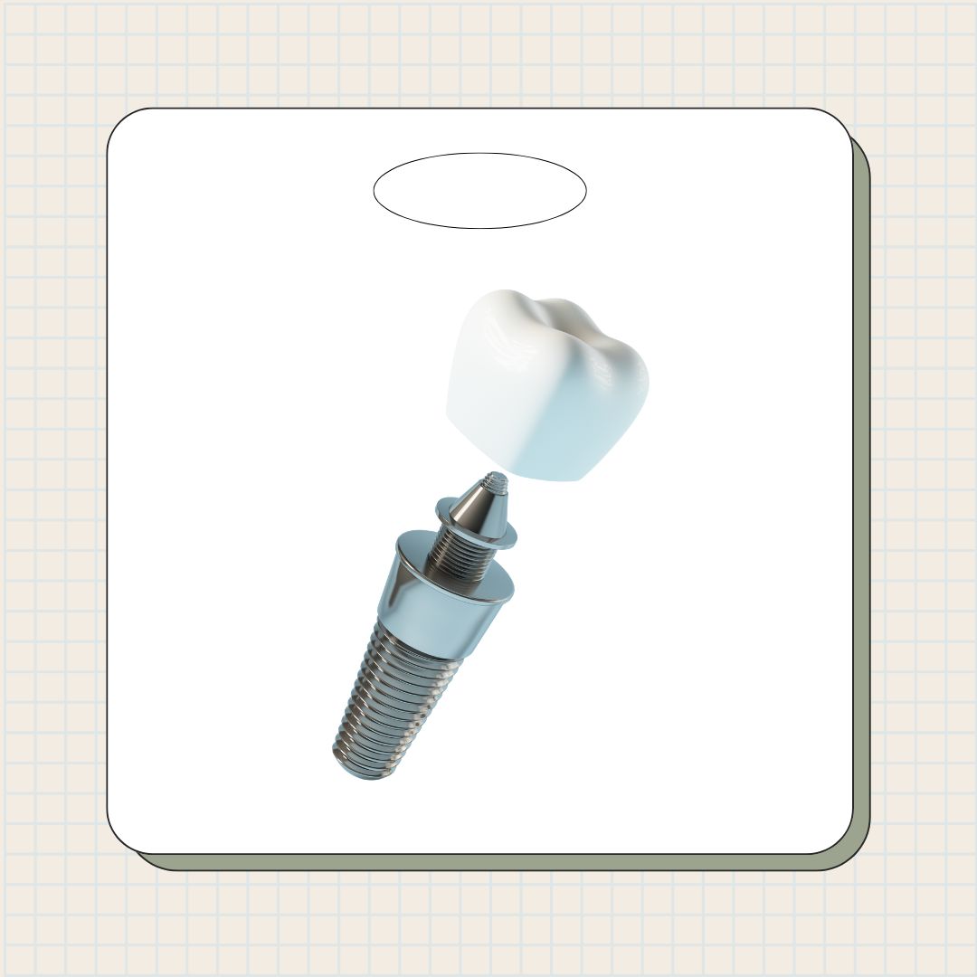 노인임플란트 국가지원