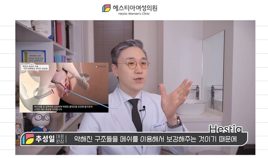 요실금약
요실금운동