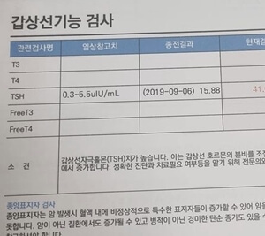 갑상선-기능-검사결과표