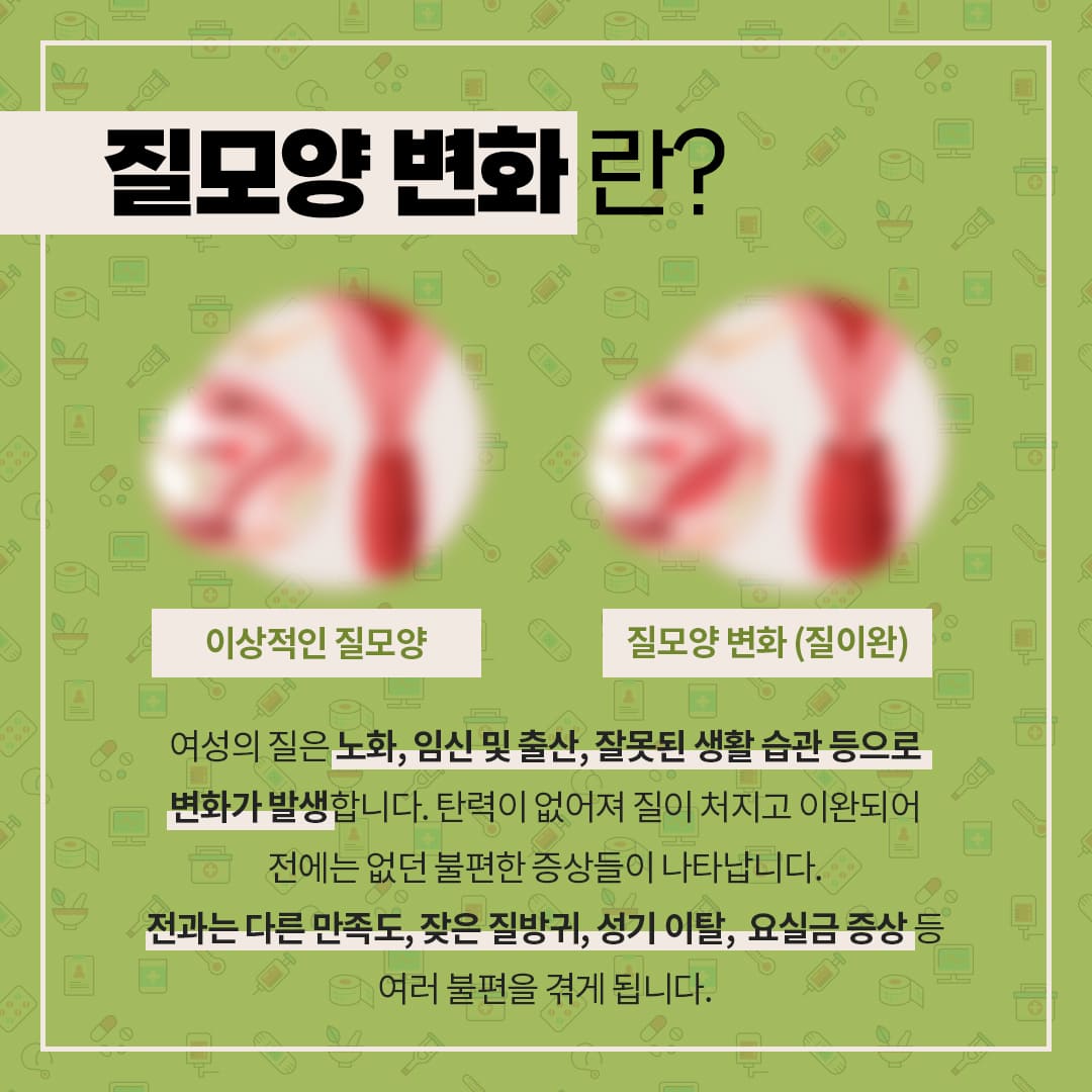 질모양 변화란?