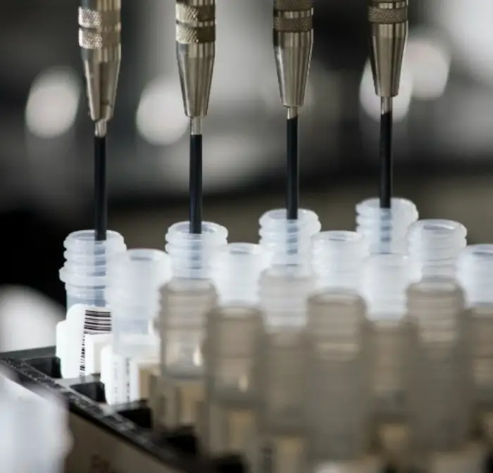 잠복결핵검사 비용