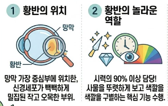 황반변성 증상