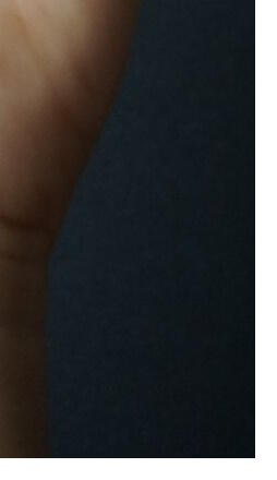 손가락수포대처법