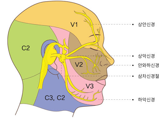 EBS 명의 삼차신경통 원인 증상 치료