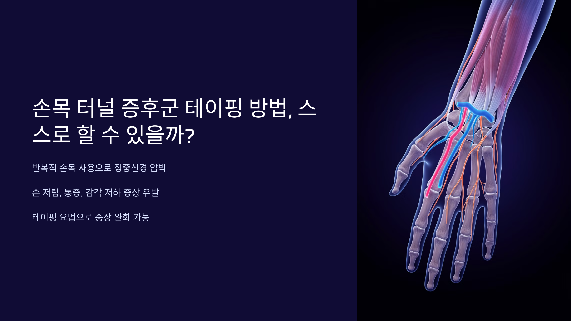 손목 터널 증후군 테이핑 방법, 스스로 할 수 있을까?