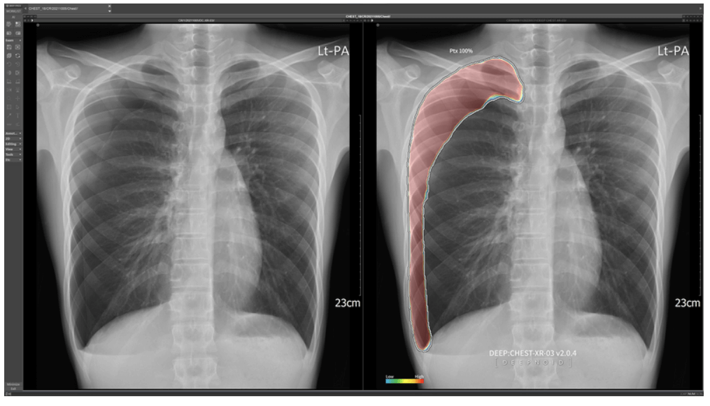 영상 분석 기술