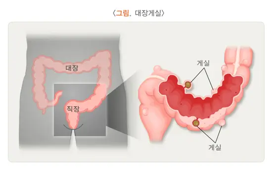 adf5db65-c011-4519-b732-c5c2bdcca811