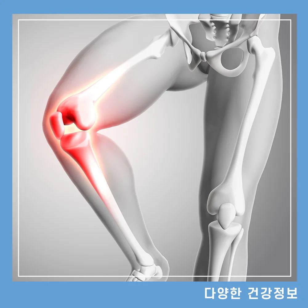 골다공증에 좋은 음식