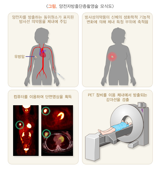 양전자방출단층촬영술 (PET) 검사 모식도