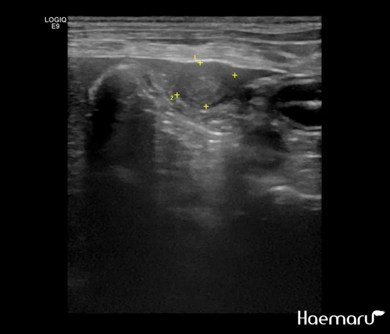 강아지 췌장암 증상 진단 치료법 안내_5