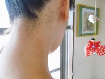 에로콤크림 코르티코이드 반응성 피부질환에서의 염증가려움 완화 전략에 대한 사용수칙_12