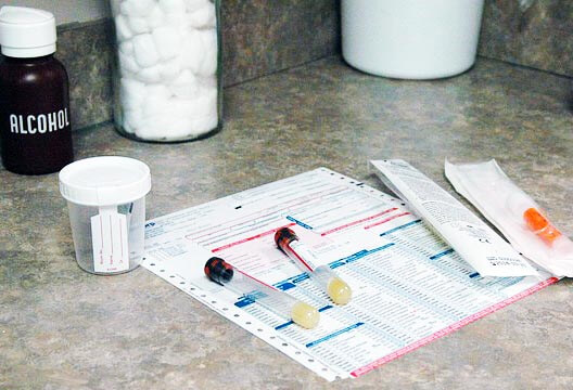 콜라색,거품,탁한 소변 의미 알아보자