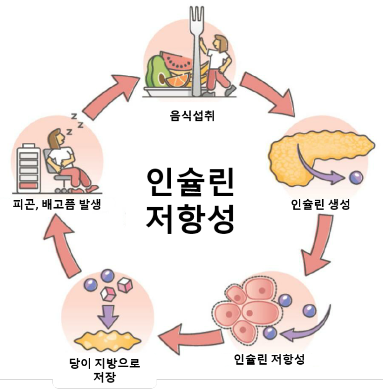 인슐린 저항성