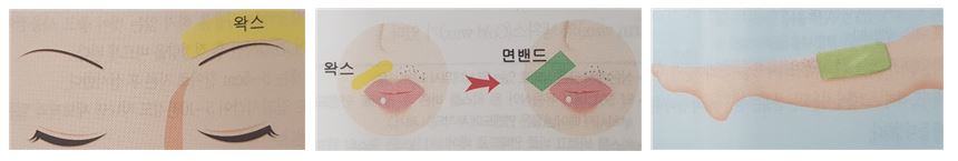 제모