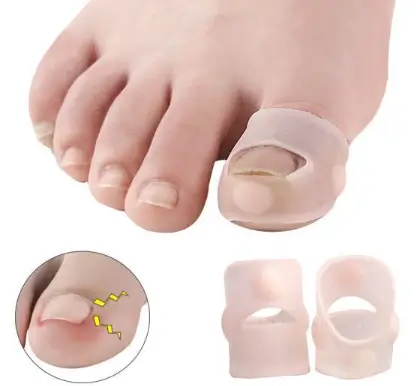 내성발톱 교정기1,2,3