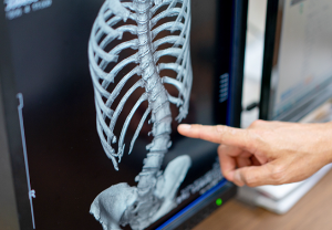 골다공증 약물의 종류와 주의점