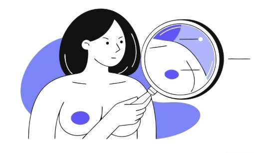 유방암2기 치료과정