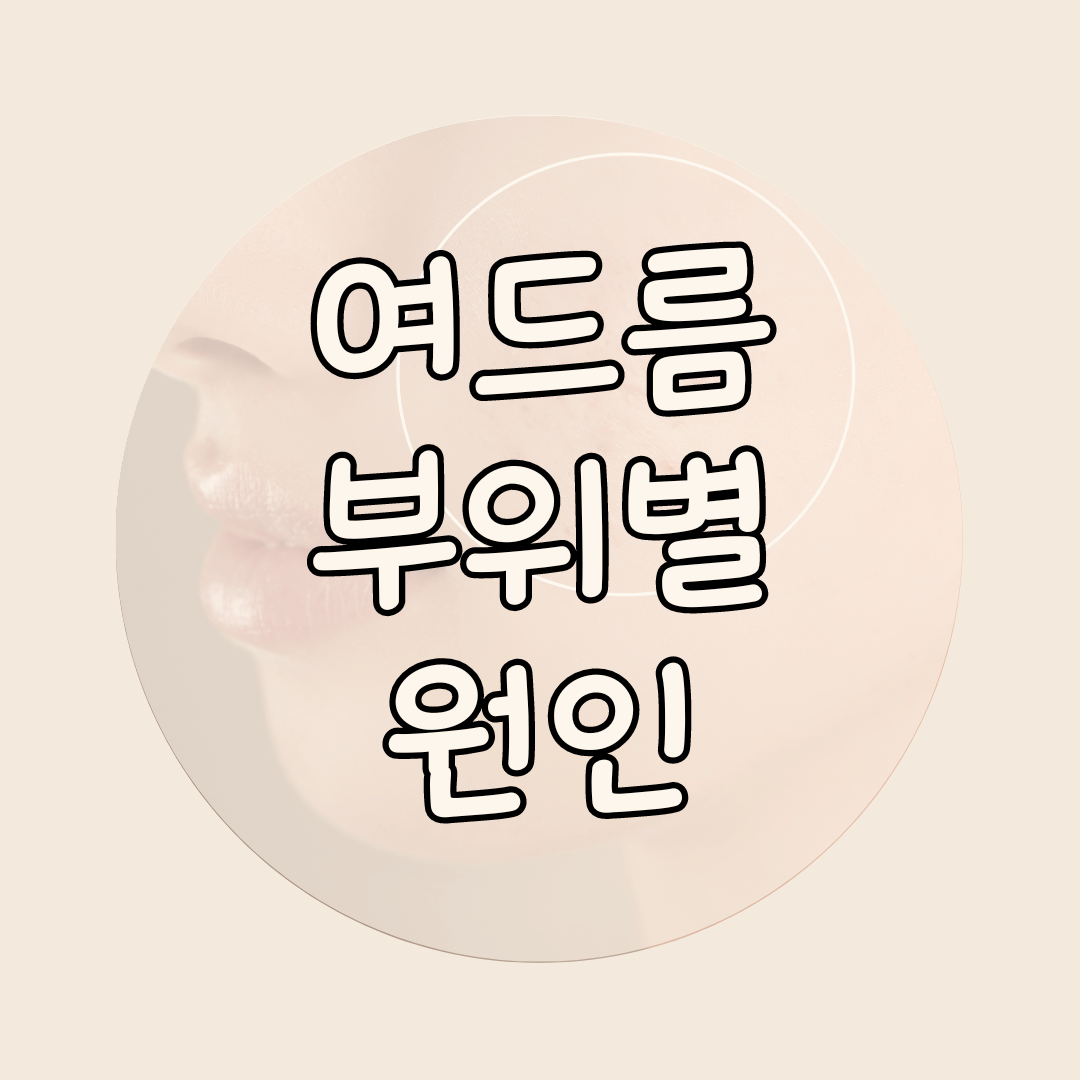 여드름 부위별 원인