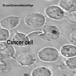 암(Cancer)
