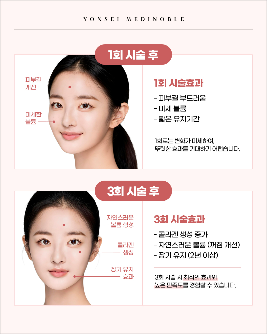 스컬트라 1회와 3회 시술 효과 차이 비교