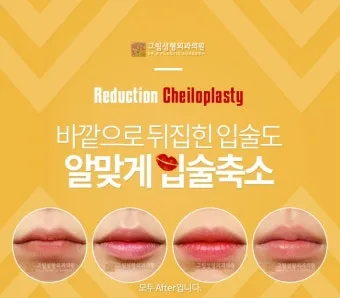 입술 두꺼운 남자 관상 특징과 해석_6