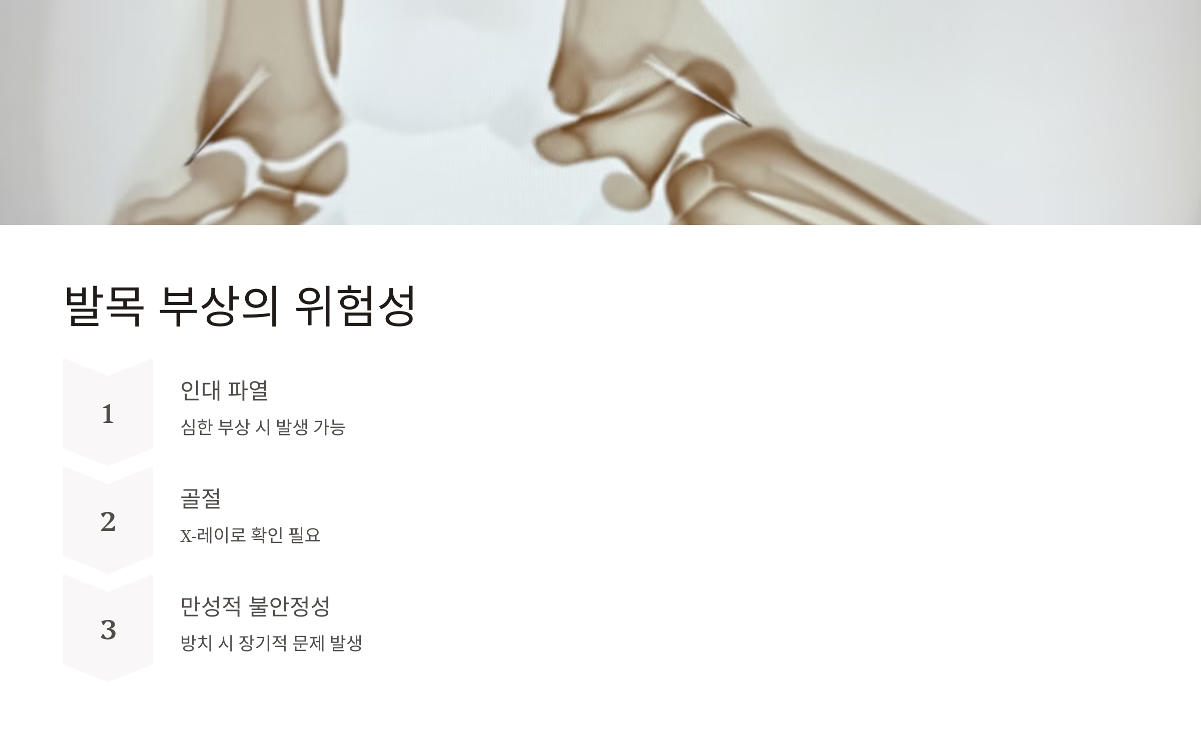 발목 접질렀을때