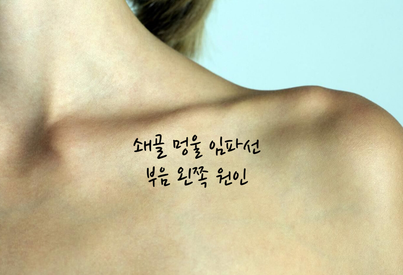 쇄골 멍울