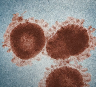 대상포진 초기증상 원인 예방 관리법