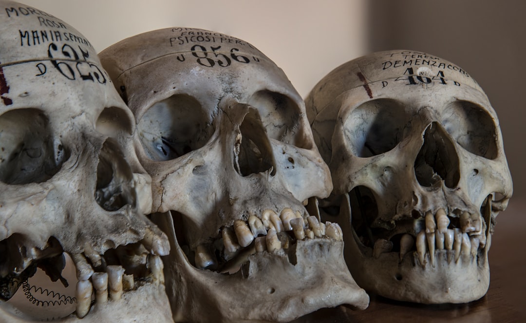 Skull