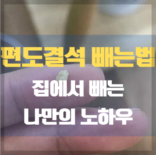 편도결석 빼는법