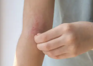 몸이 가려운 이유 12