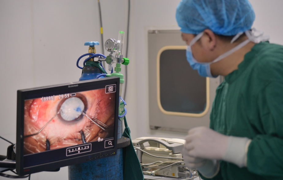 백내장 수술 모습