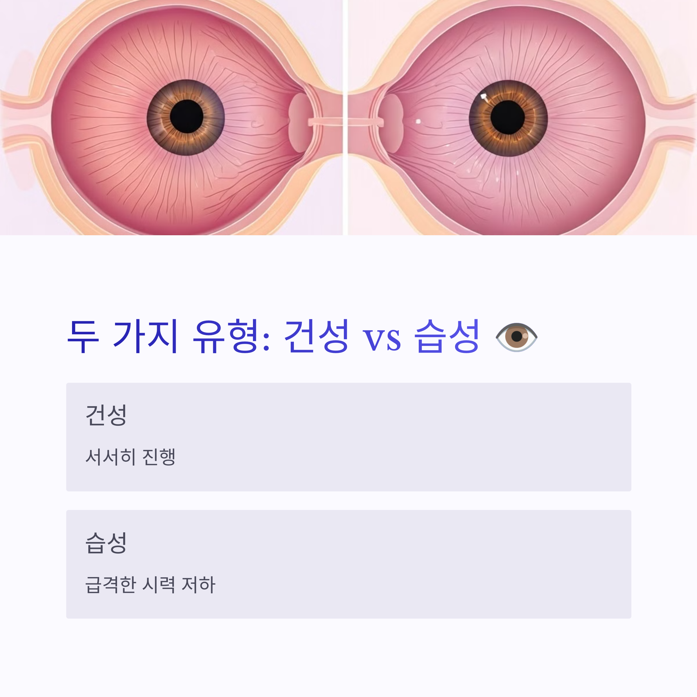 황반변성이란?초기 증상과 자가진단
