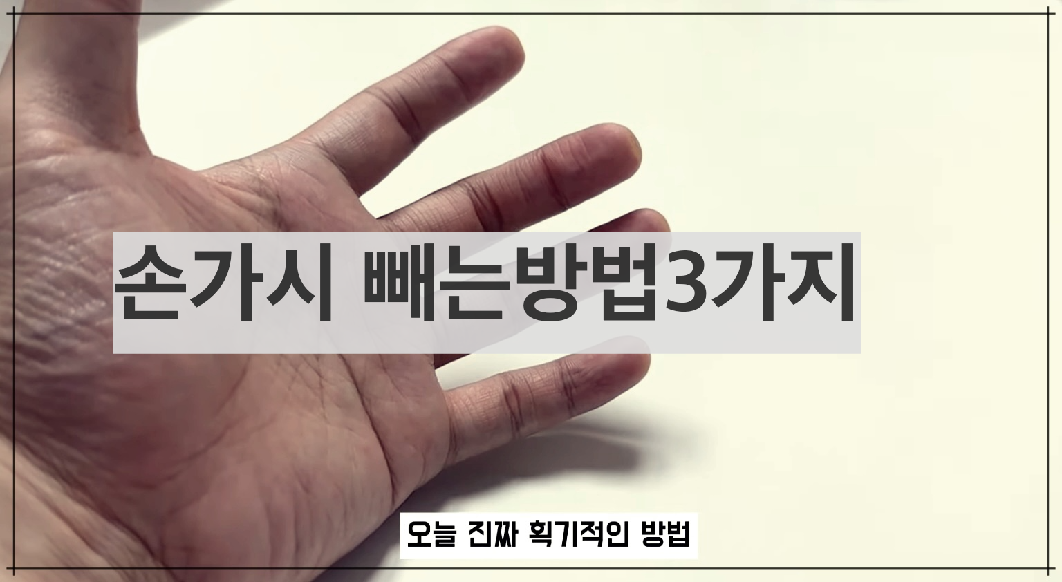 손가시빼는방법3가지