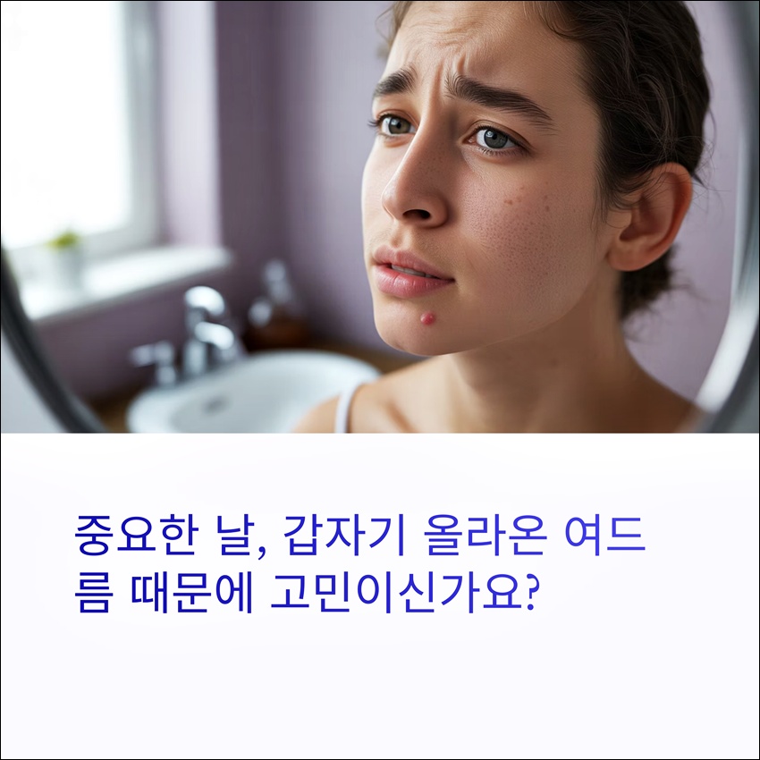 여드름 하루만에 없애는법