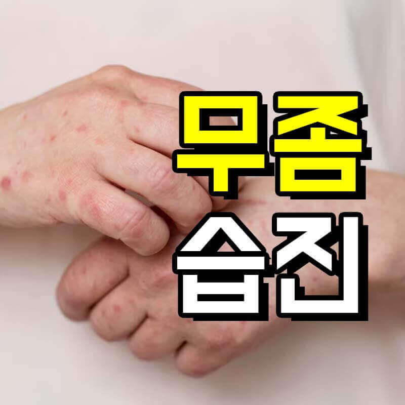 습진으로 손이 가려워 긁고 있는 모습