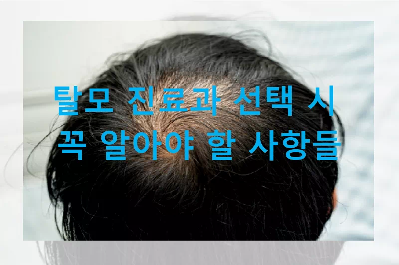 탈모 진료과 선택