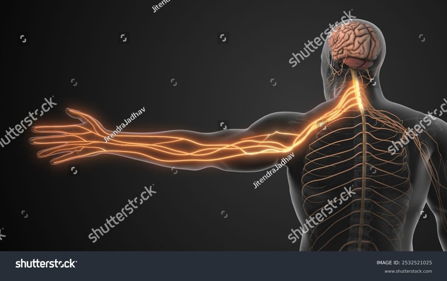 목디스크