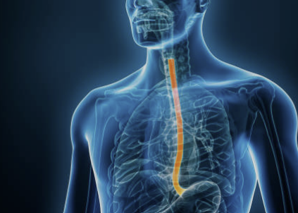 역류성 식도염 증상 자연치료 방법 알아보기!