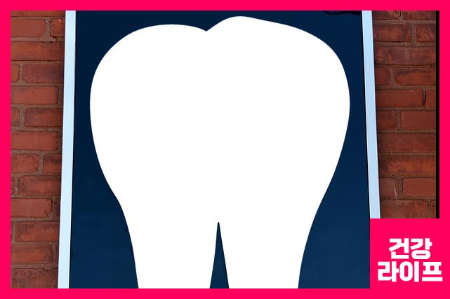 임플란트 시술 후 유지기간