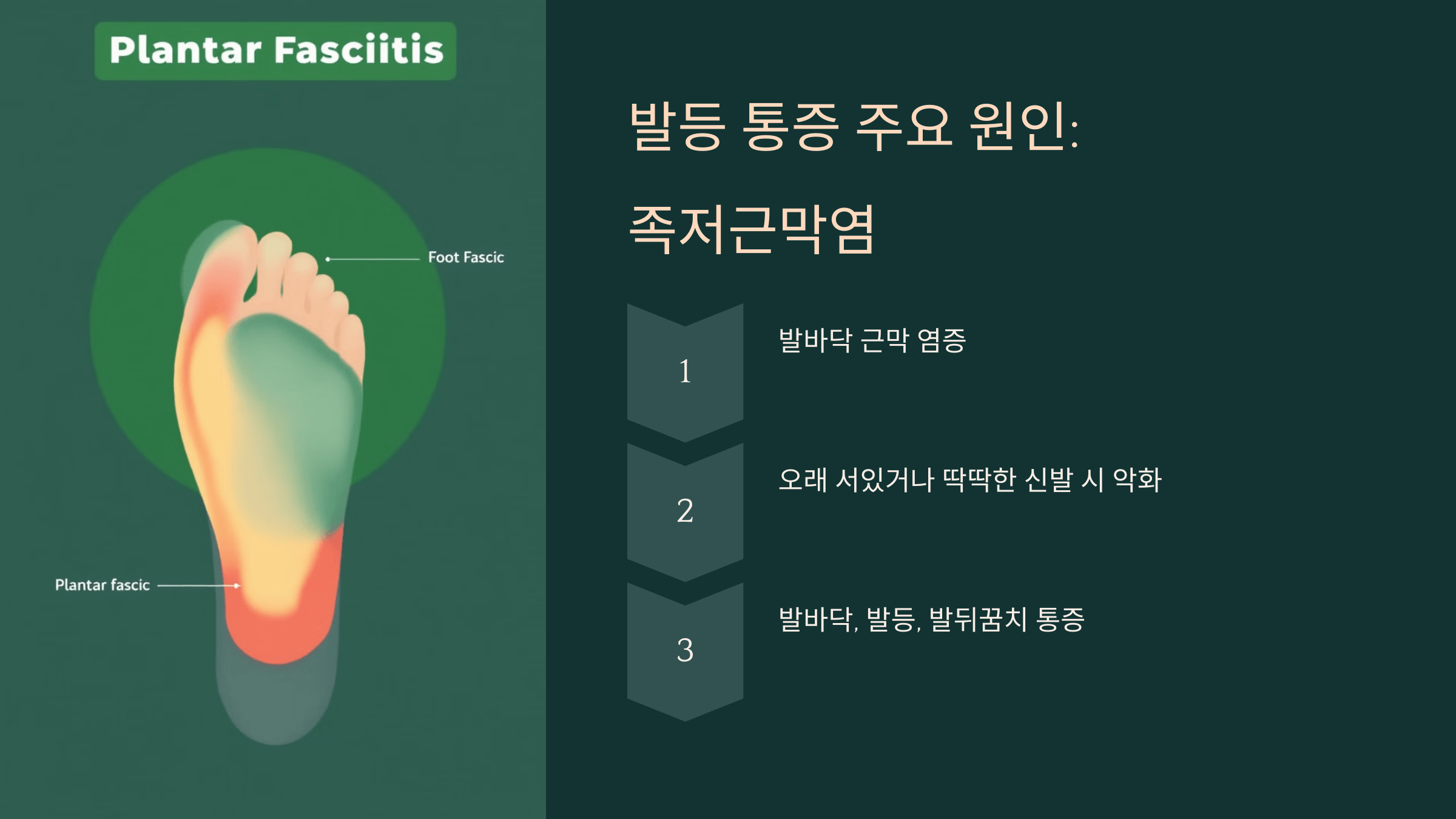 발등 사진입니다.