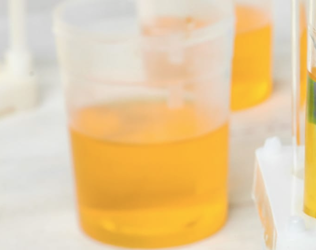 당뇨병 초기증상