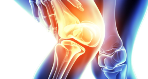 무릎 구부릴 때2