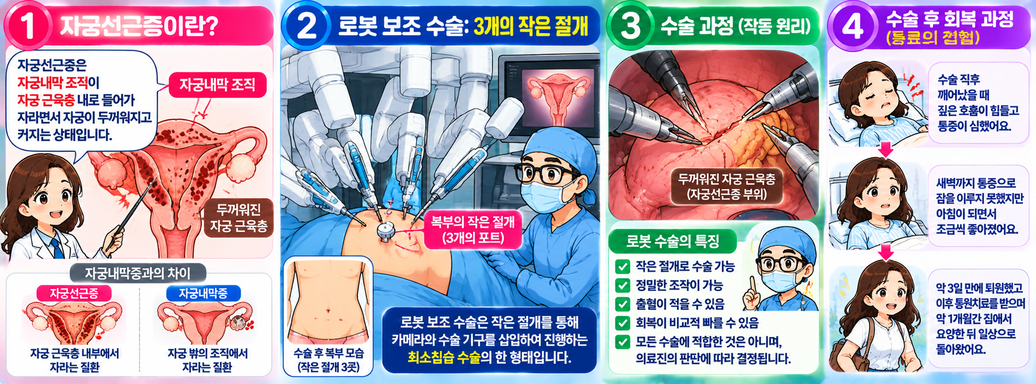 복부의 작은 절개를 이용해 진행된 자궁선근증 로봇 보조 수술 과정