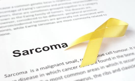 육종 (Sarcoma)의 유형과 증상, 치료
