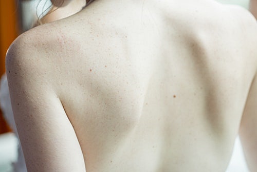 14. 브라질 너트