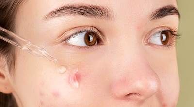 종기가 생기는 이유