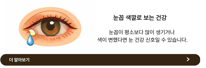 눈꼽이 잘 끼는 이유